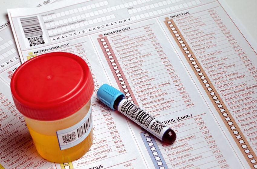  Do CDL Schools Drug Test?