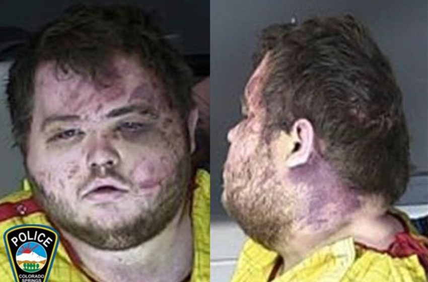  Colorado Springs gay club shooting suspect held without bail – KTLA Los Angeles