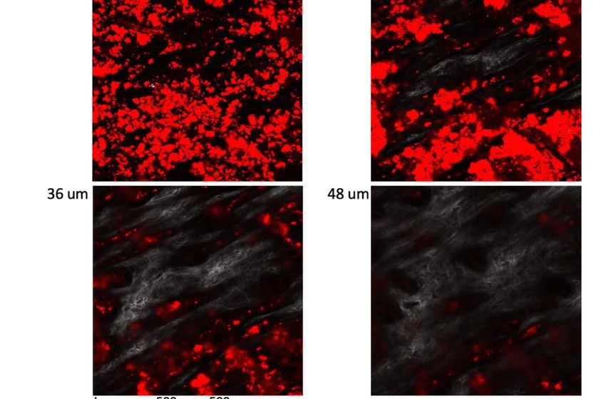  ‘Bliss’ compound may hold out hope for autoimmune skin disease