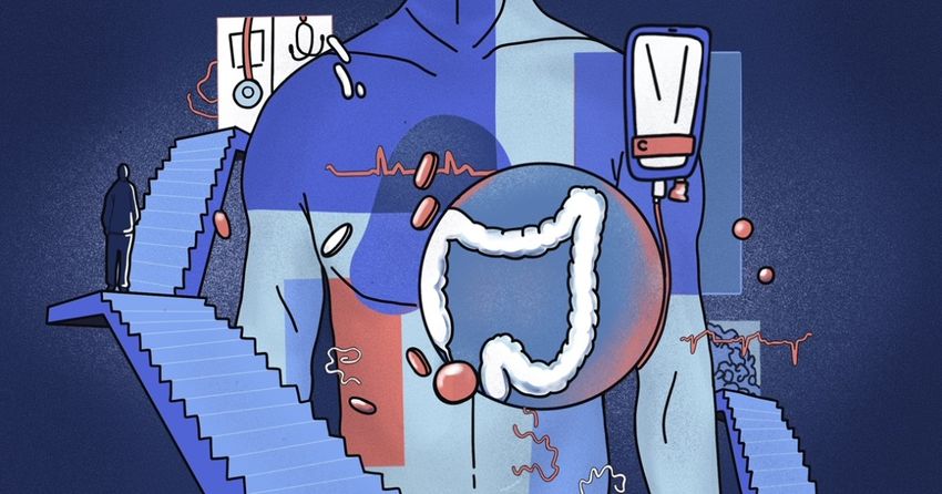  People who got colon cancer in their 20s or 30s describe what it was like and the signs that were ignored