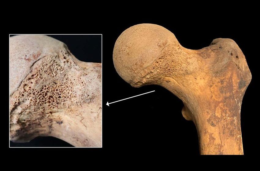  Traces of cannabis found in pre-modern human bones for the first time