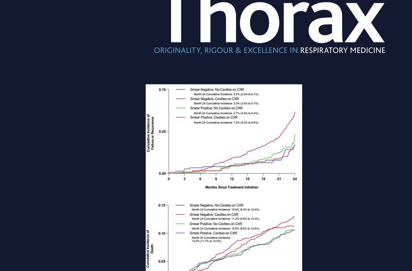  Prospective study of e-cigarette use and respiratory symptoms in adolescents and young adults