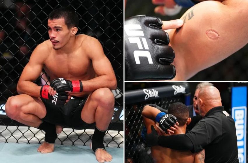  Igor Severino disqualified and then released by UFC after biting opponent