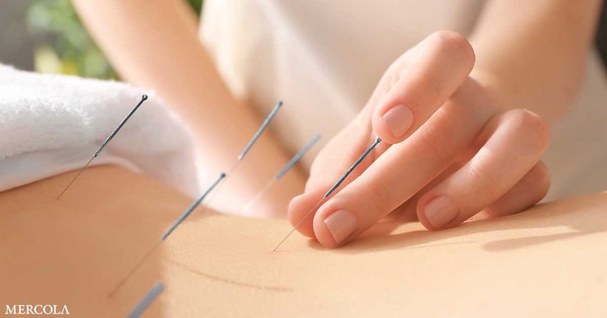  Study Reveals Previously Unknown Mechanism Behind Acupuncture’s Ability to Reduce Pain