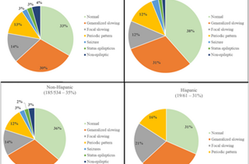  Racial disparities in urine drug screening among seizure patients in the emergency department