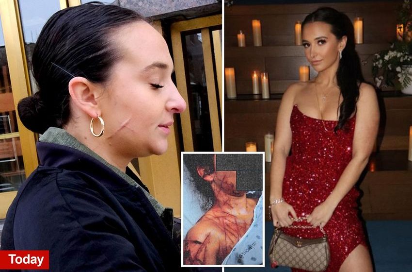  Ex-NJ GOP aide still carries visible scars after she paid fetish artist to carve her up as part of Trump attack hoax