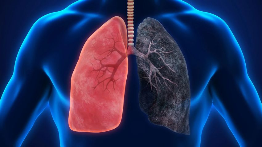  Heavy marijuana smoking may increase cancer risk, researchers warn