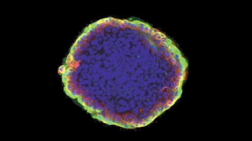  Scientists Discover a Cannabis Receptor That Could Stop Breast Cancer Spreading